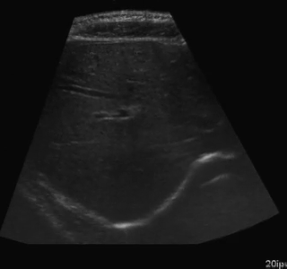 Segmentation Example