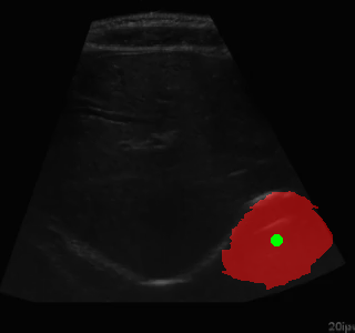 Segmentation Example
