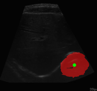Segmentation Example